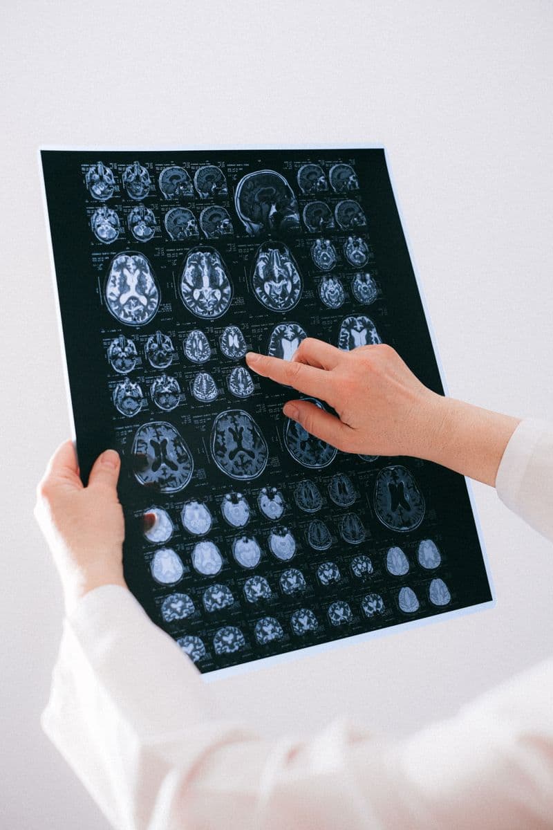 Neurosurgery